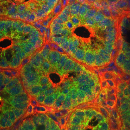 The anti-malarial drug chloroquine increases lifespan in male mice