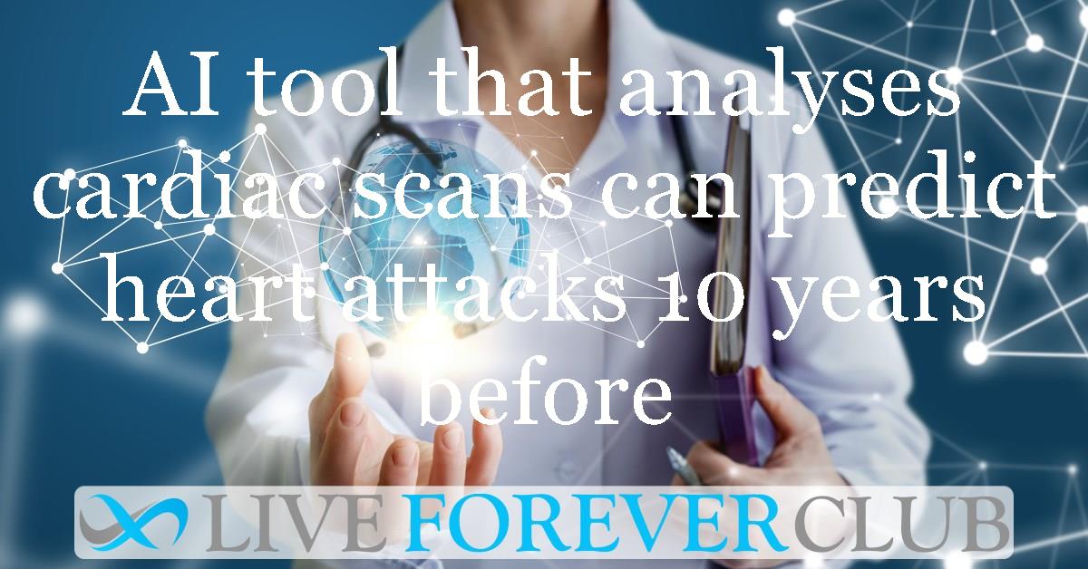 AI tool that analyses cardiac scans can predict heart attacks 10 years before