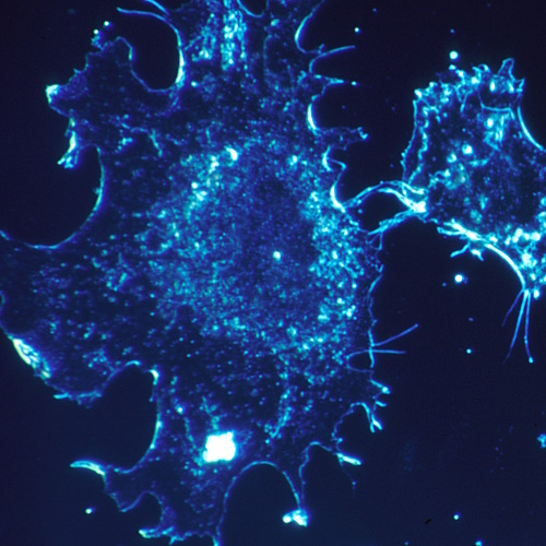 AI finds a common target for liver cancer and ageing