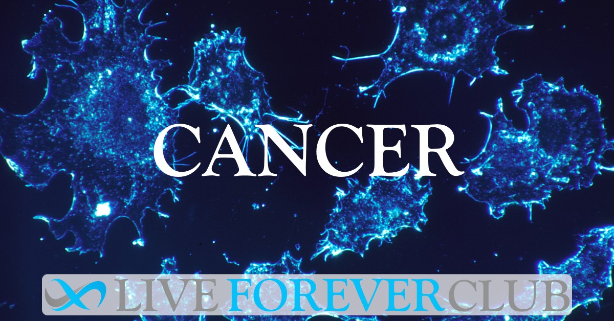 Melanoma Skin Cancer