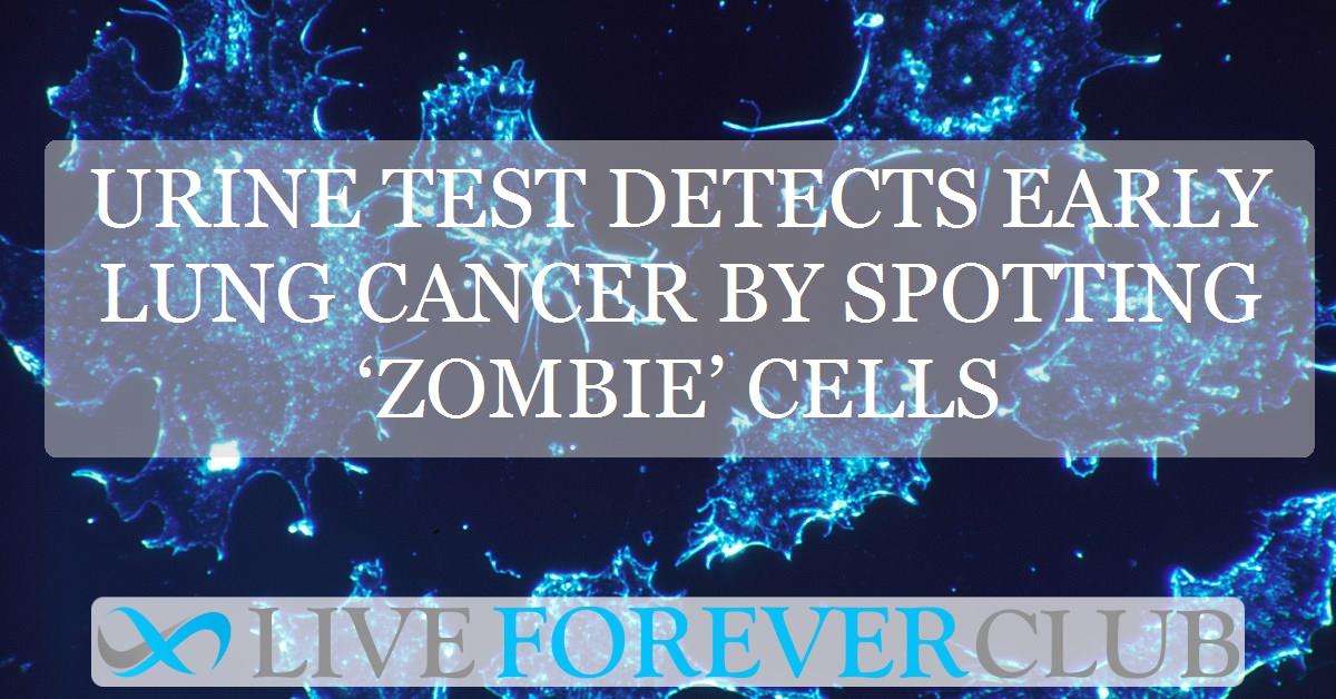 Urine test detects early lung cancer by spotting ‘zombie’ cells