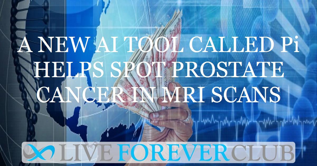 A new AI tool called Pi helps spot prostate cancer in MRI scans