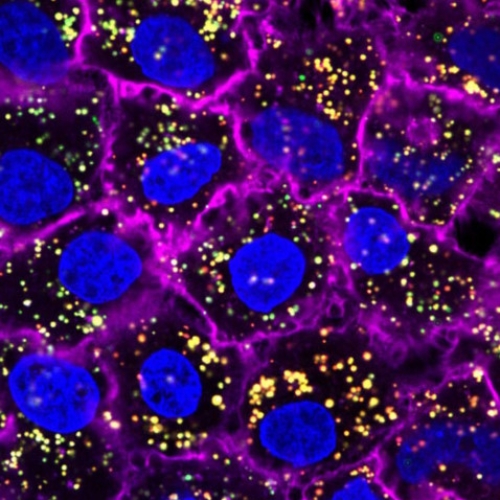 Nanoparticles deliver tools to fix gene mistakes in lung cells