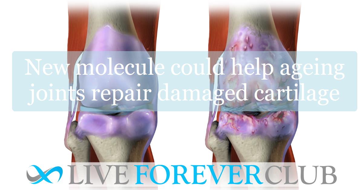 New molecule could help ageing joints repair damaged cartilage