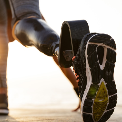 Bionic knee connects to muscle and bone for natural movement