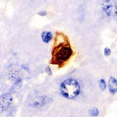 s/senescent-cells/senescent-cells-thumbnail.jpg
