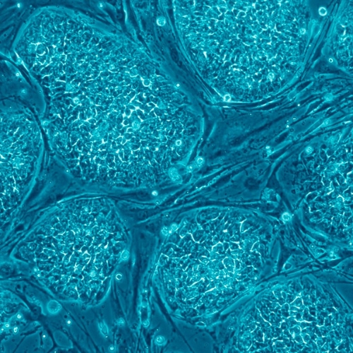 Genetically enhanced stem cells reversed ageing in monkeys