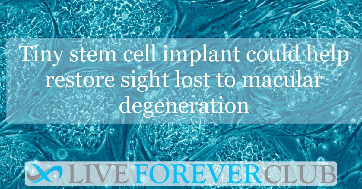 Tiny stem cell implant could help restore sight lost to macular degeneration