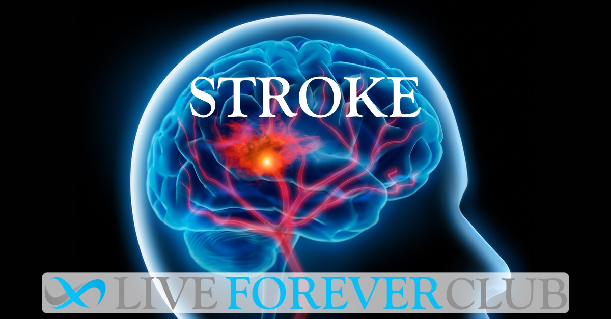 Ischaemic Stroke