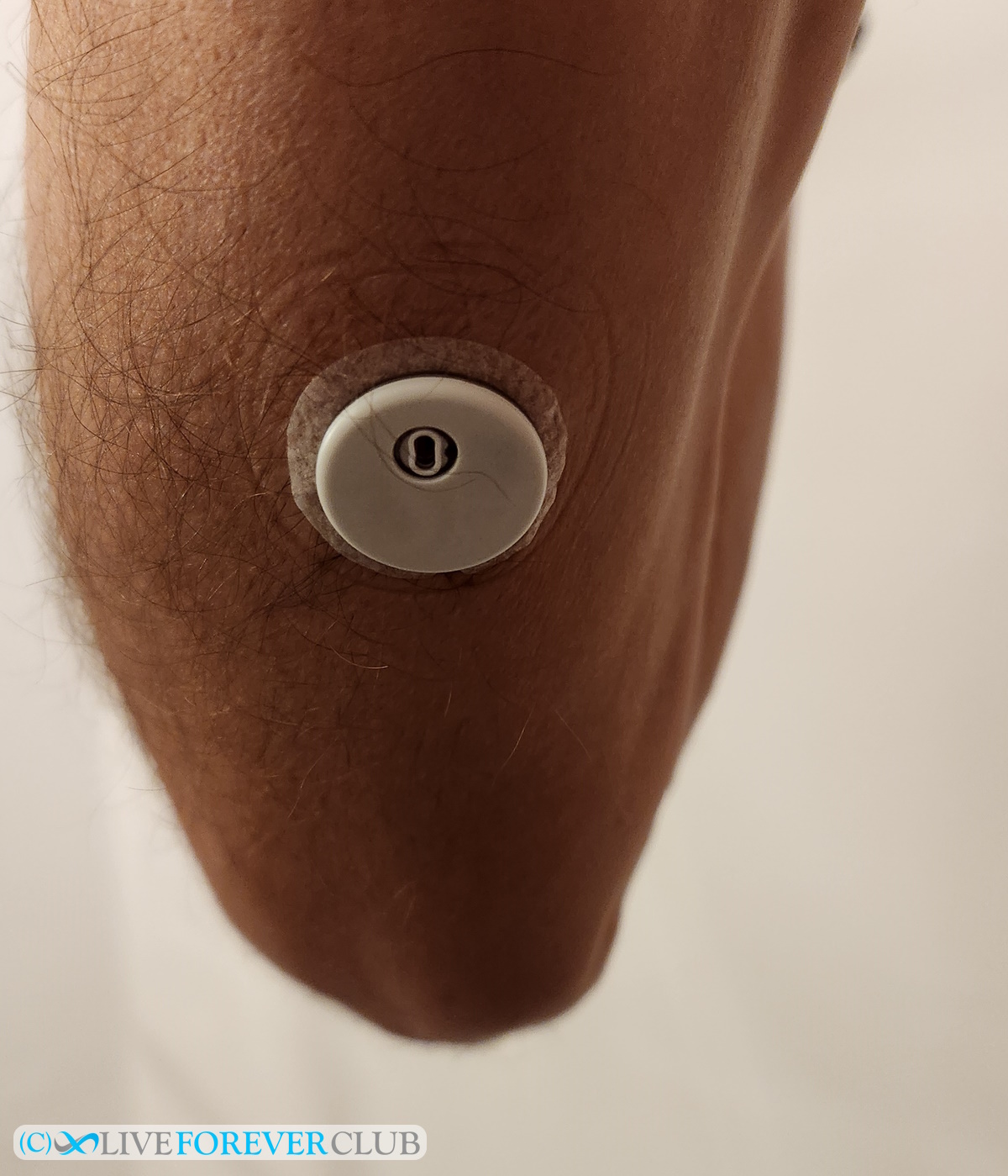 freestyle libre CGM sensor